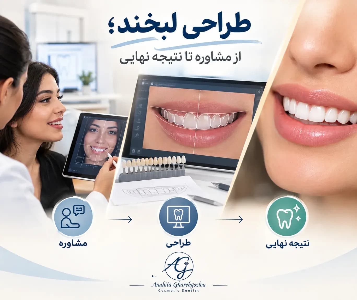 طراحی لبخند؛ از مشاوره تا نتیجه نهایی