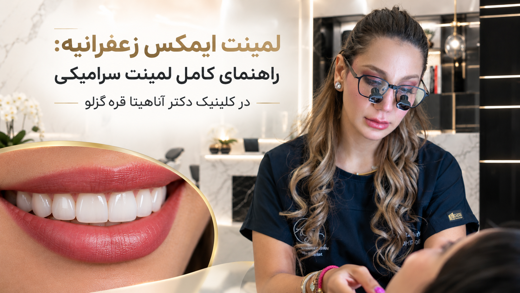 لمینت ایمکس زعفرانیه در کلینیک دندانپزشکی دکتر آناهیتا قره‌گزلو