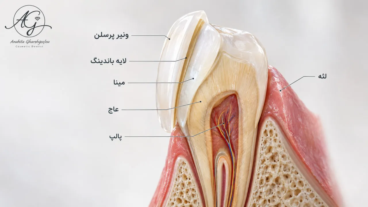 اصطلاحات کلیدی دندان